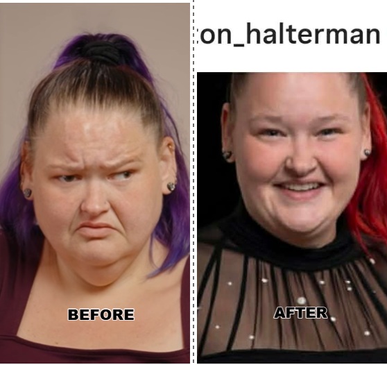 1000-lb Sisters - Amy Slaton Before and After Eye surgery