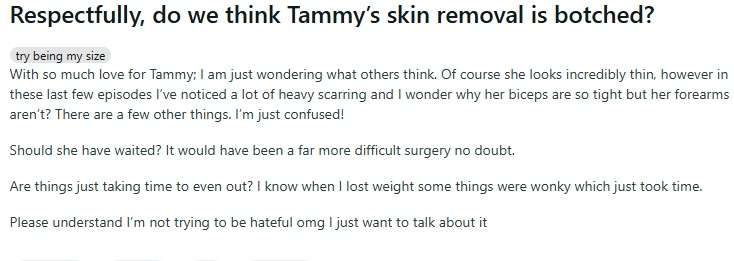 Reddit Tammy Slaton - Botched