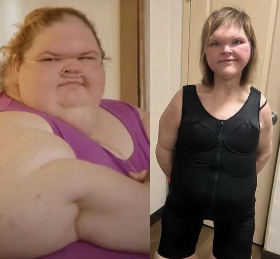 1000-Lb Sisters Tammy Slaton Before & After